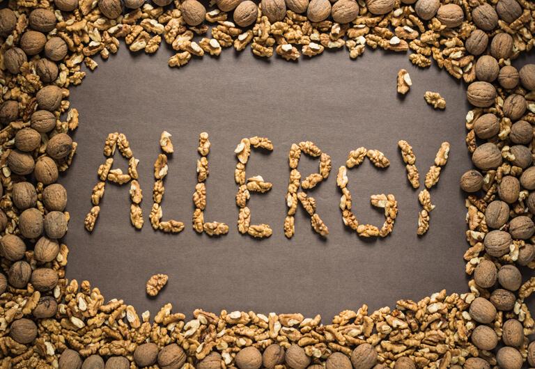 How to care for a child with nut allergy.